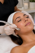 Microdermabrasion Facial