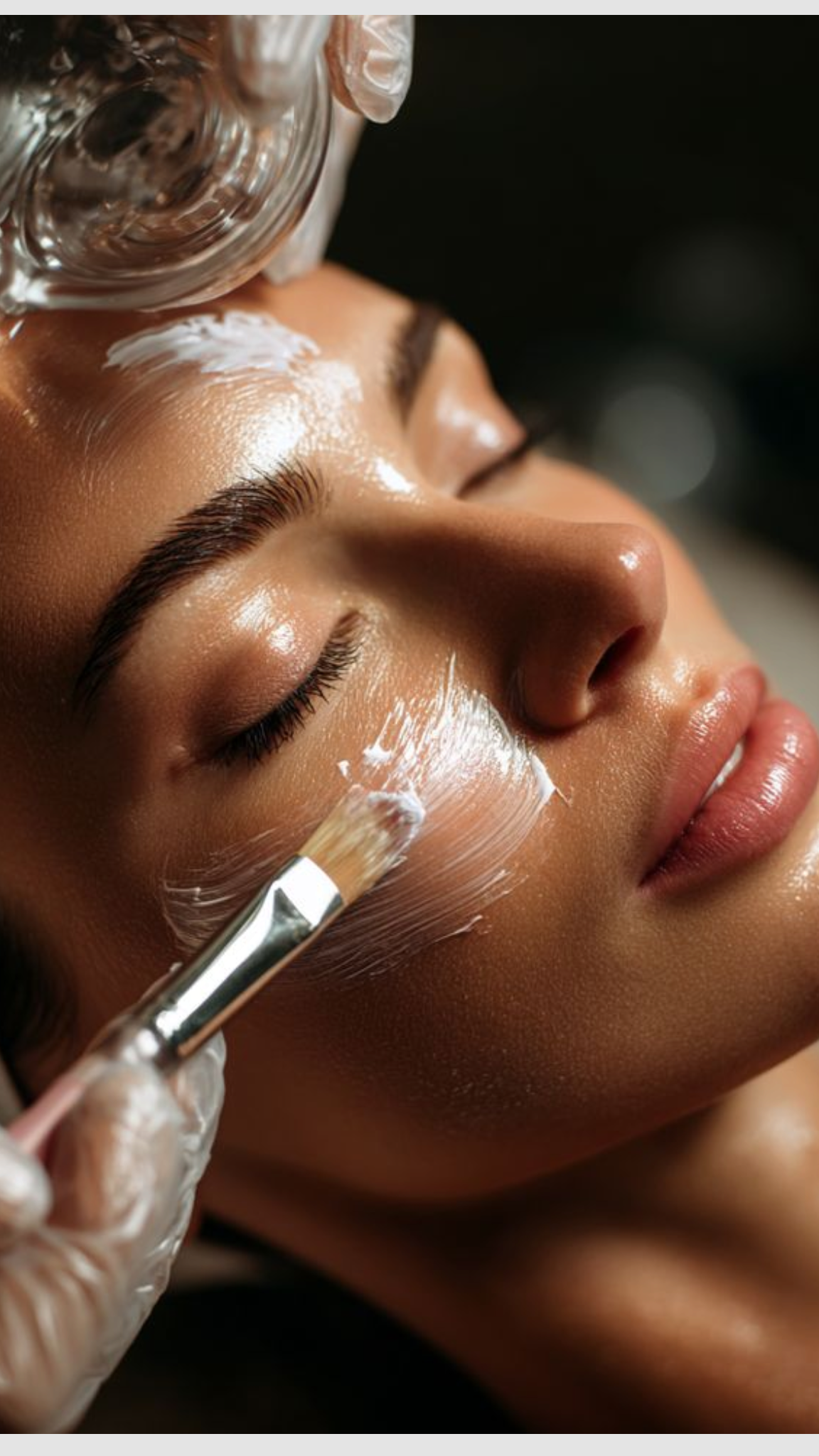Chemical Peel